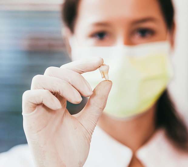 Redwood City Tooth Extraction