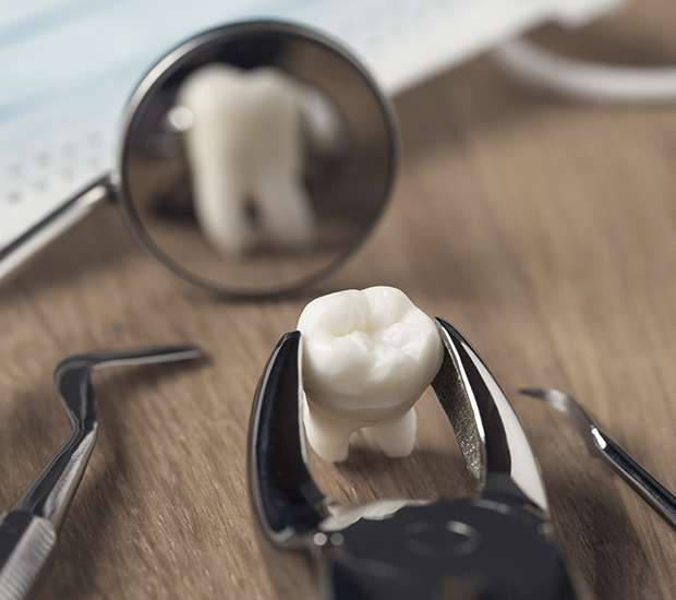 Redwood City When Is a Tooth Extraction Necessary